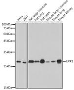 UPP1 Recombinant Rabbit Monoclonal Antibody (3E2I2)