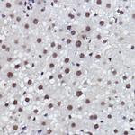 MED4 Antibody in Immunohistochemistry (Paraffin) (IHC (P))