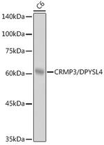 CRMP3 Antibody in Western Blot (WB)
