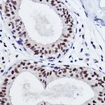 SNRPA1 Recombinant Rabbit Monoclonal Antibody (2D7M1)