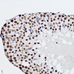 SNRPA1 Antibody in Immunohistochemistry (Paraffin) (IHC (P))
