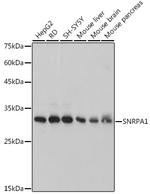 SNRPA1 Antibody in Western Blot (WB)