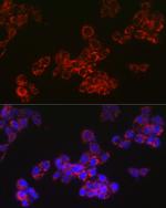 ACAA2 Antibody in Immunocytochemistry (ICC/IF)