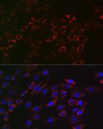 ACAA2 Recombinant Rabbit Monoclonal Antibody (8H6H5)