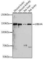 UBE4A Recombinant Rabbit Monoclonal Antibody (2A5N2)