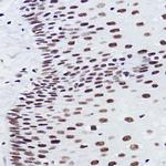 BRMS1 Recombinant Rabbit Monoclonal Antibody (5Y8J3)