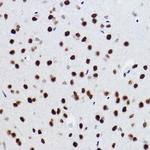 BRMS1 Antibody in Immunohistochemistry (Paraffin) (IHC (P))