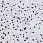 BRMS1 Antibody in Immunohistochemistry (Paraffin) (IHC (P))