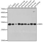 SBDS Recombinant Rabbit Monoclonal Antibody (9V4J9)