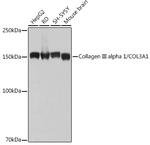 Collagen III Recombinant Rabbit Monoclonal Antibody (6Y9C6)