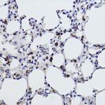 MGST1 Antibody in Immunohistochemistry (Paraffin) (IHC (P))