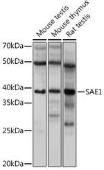 SAE1 Recombinant Rabbit Monoclonal Antibody (0L2N2)