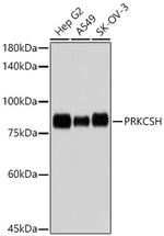 PRKCSH Recombinant Rabbit Monoclonal Antibody (4Z3K3)