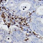 NCF4 Antibody in Immunohistochemistry (Paraffin) (IHC (P))