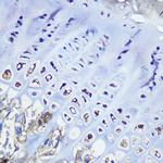 Aggrecan Recombinant Rabbit Monoclonal Antibody (6L4T2)