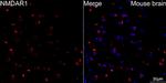 NMDAR1 Recombinant Rabbit Monoclonal Antibody (1H1T3)