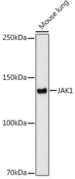 JAK1 Recombinant Rabbit Monoclonal Antibody (7Q1B2)