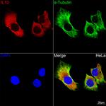 IL-10 Recombinant Rabbit Monoclonal Antibody (6U0G7)