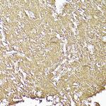 CD90 (Thy1) Antibody in Immunohistochemistry (Paraffin) (IHC (P))