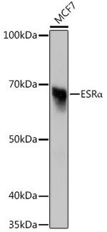 Estrogen Receptor alpha Recombinant Rabbit Monoclonal Antibody (4L8K5)