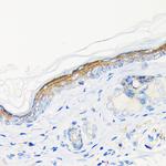 Involucrin Antibody in Immunohistochemistry (Paraffin) (IHC (P))