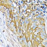 Involucrin Recombinant Rabbit Monoclonal Antibody (8H7B3)