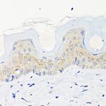 Involucrin Antibody in Immunohistochemistry (Paraffin) (IHC (P))