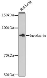 Involucrin Antibody in Western Blot (WB)
