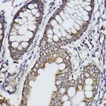 FKTN Antibody in Immunohistochemistry (Paraffin) (IHC (P))