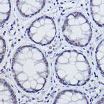 USP39 Recombinant Rabbit Monoclonal Antibody (9E7O2)