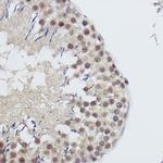 USP39 Antibody in Immunohistochemistry (Paraffin) (IHC (P))
