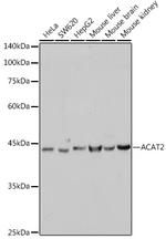ACAT2 Recombinant Rabbit Monoclonal Antibody (6Z5L1)