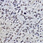 PDCD7 Recombinant Rabbit Monoclonal Antibody (8A1Q3)