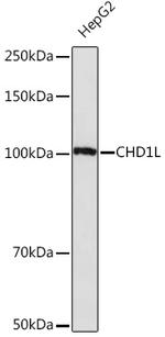 CHD1L Recombinant Rabbit Monoclonal Antibody (3C1O9)