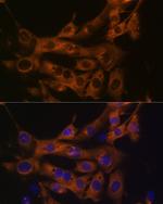 FASN Recombinant Rabbit Monoclonal Antibody (4U9S3)