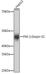 PAI1 Recombinant Rabbit Monoclonal Antibody (6L6Y7)