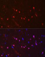 S100B Antibody in Immunohistochemistry (Paraffin) (IHC (P))