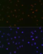 SPT5 Antibody in Immunocytochemistry (ICC/IF)