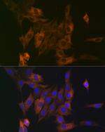 LPP Recombinant Rabbit Monoclonal Antibody (8M2R8)