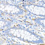 LPP Antibody in Immunohistochemistry (Paraffin) (IHC (P))