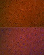 Syntaxin 1 Antibody in Immunohistochemistry (Paraffin) (IHC (P))
