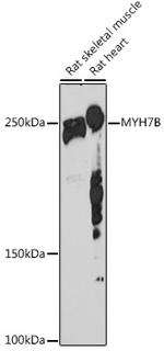 MYH7B Recombinant Rabbit Monoclonal Antibody (7W8J3)