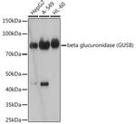 GUSB Recombinant Rabbit Monoclonal Antibody (4U0E2)