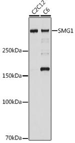 SMG1 Recombinant Rabbit Monoclonal Antibody (5N10C7)