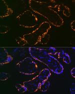 CSH1 Antibody in Immunohistochemistry (Paraffin) (IHC (P))