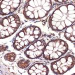 CC2D1A Recombinant Rabbit Monoclonal Antibody (5Y6S6)