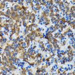 Thyroid Peroxidase Recombinant Rabbit Monoclonal Antibody (3C4A4)
