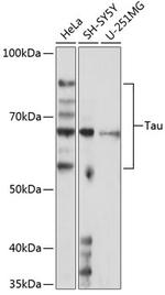 Tau Antibody in Western Blot (WB)