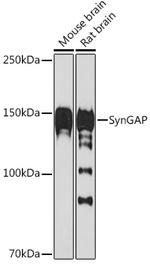 SynGAP Recombinant Rabbit Monoclonal Antibody (8M2S9)