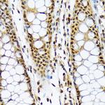 MAD2L1BP Recombinant Rabbit Monoclonal Antibody (7W8H1)